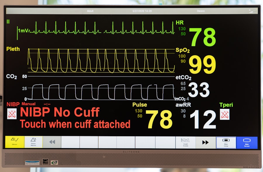 Photo Heart Rate Variability