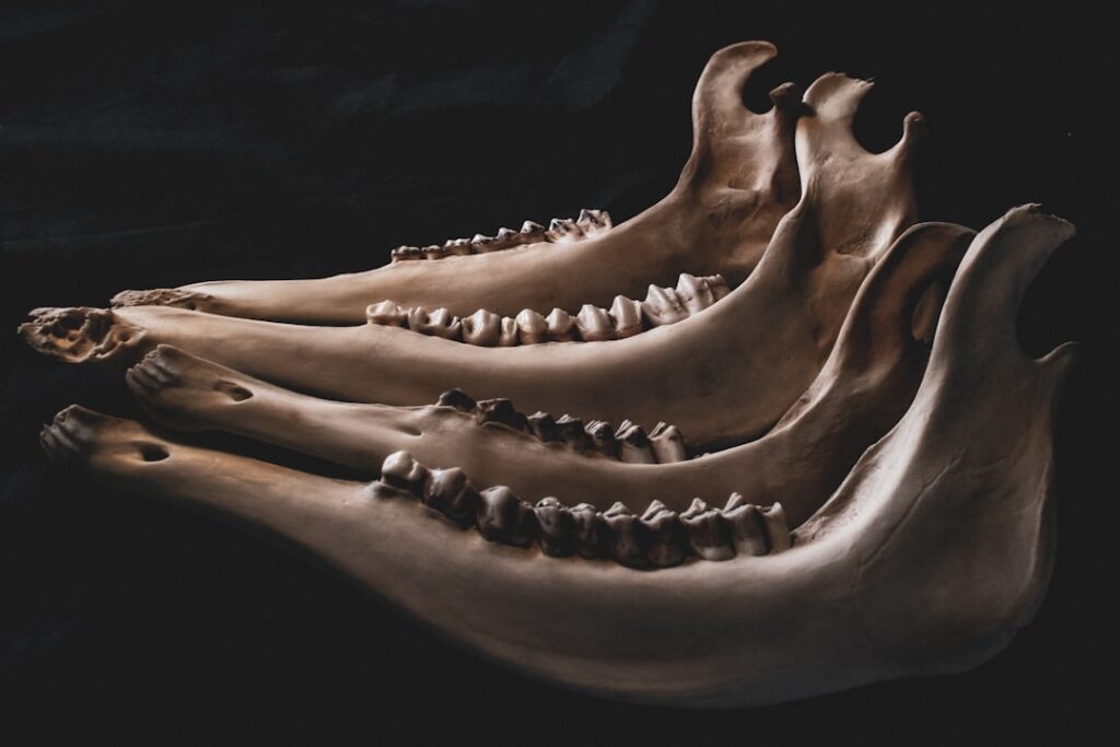 Photo Bone Density