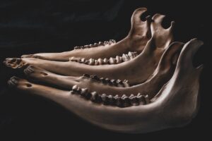 Photo Bone Density